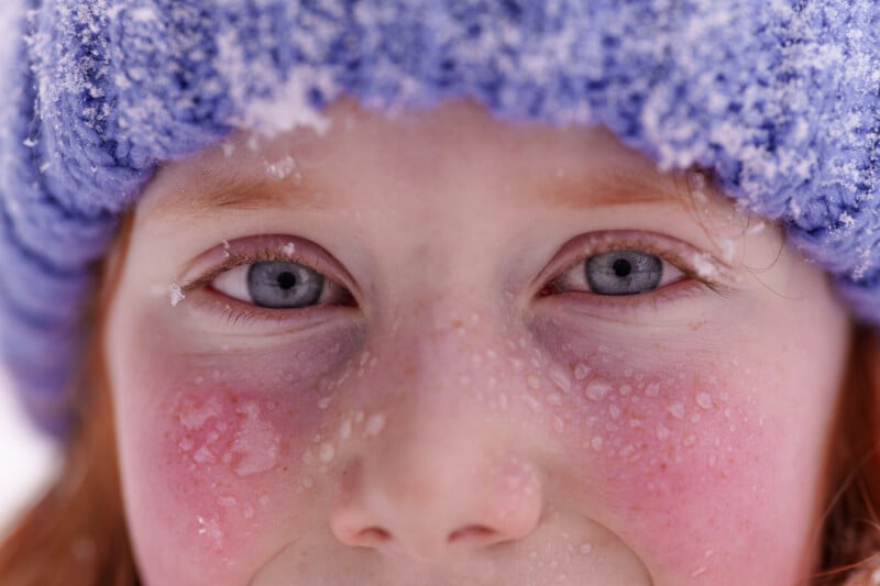 Close-up of a child's face with blue eyes and rosy cheeks, wearing a blue knitted hat dusted with snowflakes. The child's skin is slightly freckled and features tiny melted snow droplets, capturing a wintry atmosphere.